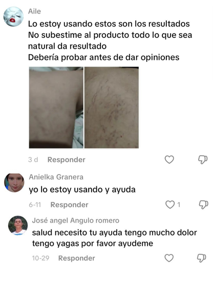 Parches para varices