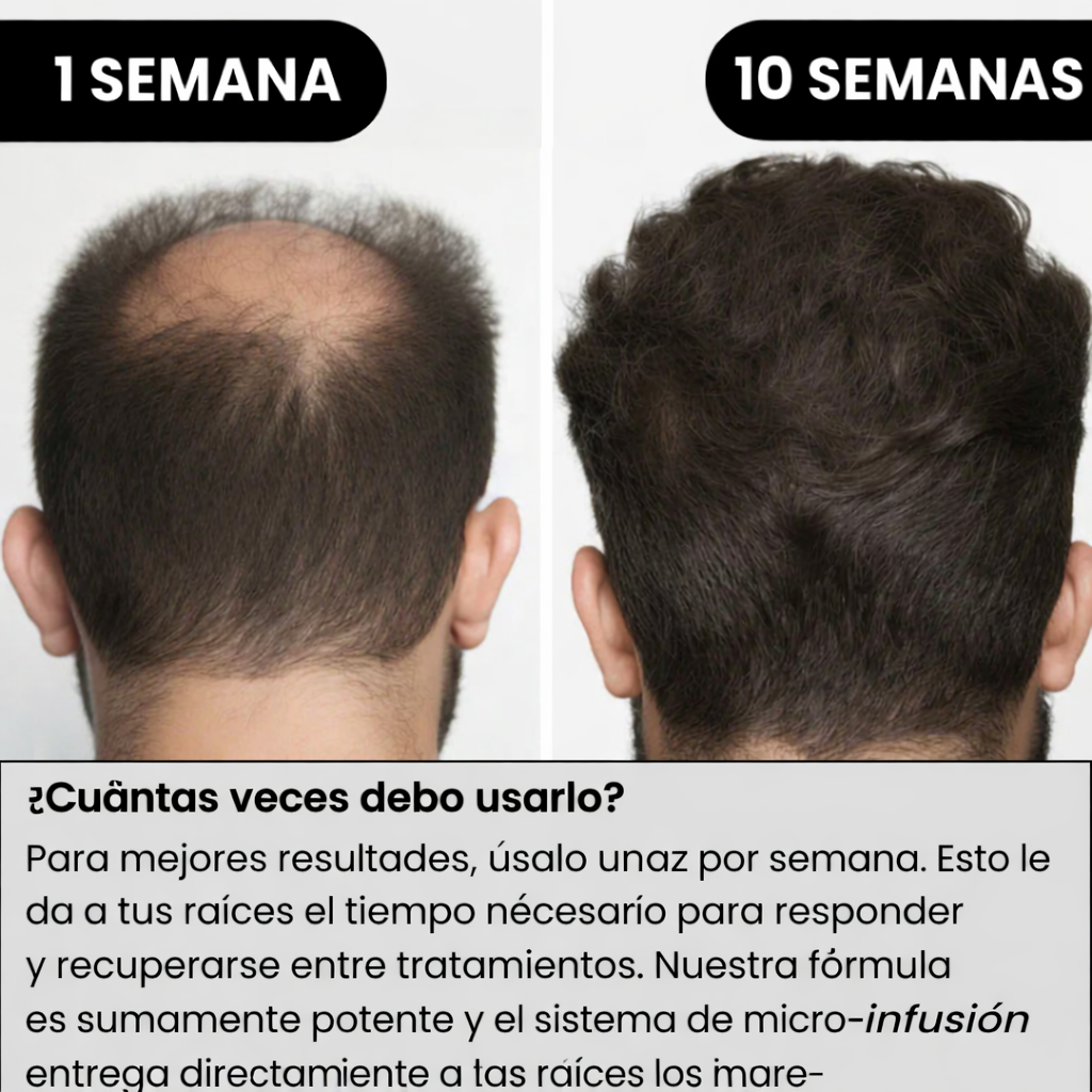 Sistema de regeneración capilar