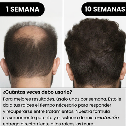 Sistema de regeneración capilar